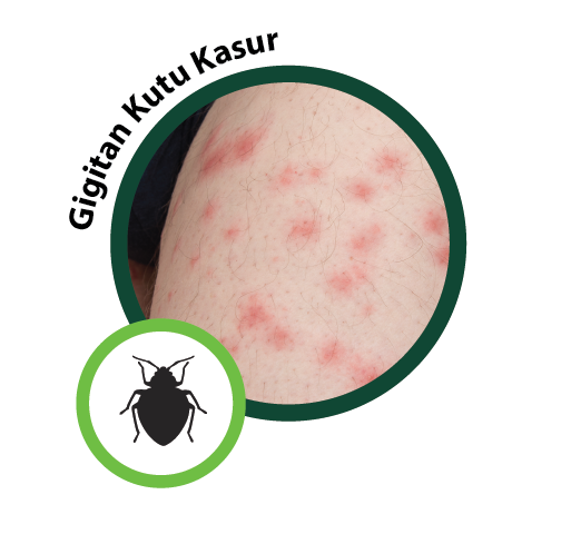 gigitan kutu kasur dapat di redakan dengan Zambuk